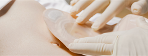 A Practice-embedded, PDSA-guided Implementation Study of Continuing Professional Development for Stoma Care in a Resource-constrained Setting
