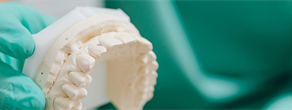Dental Care Professionals' Experience with the 2017 Periodontal Disease Classification